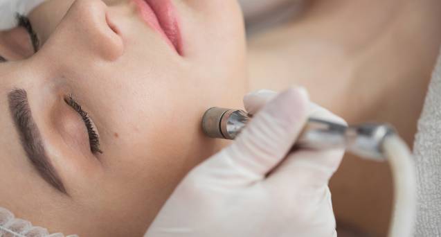 woman receiving microdermabrasion