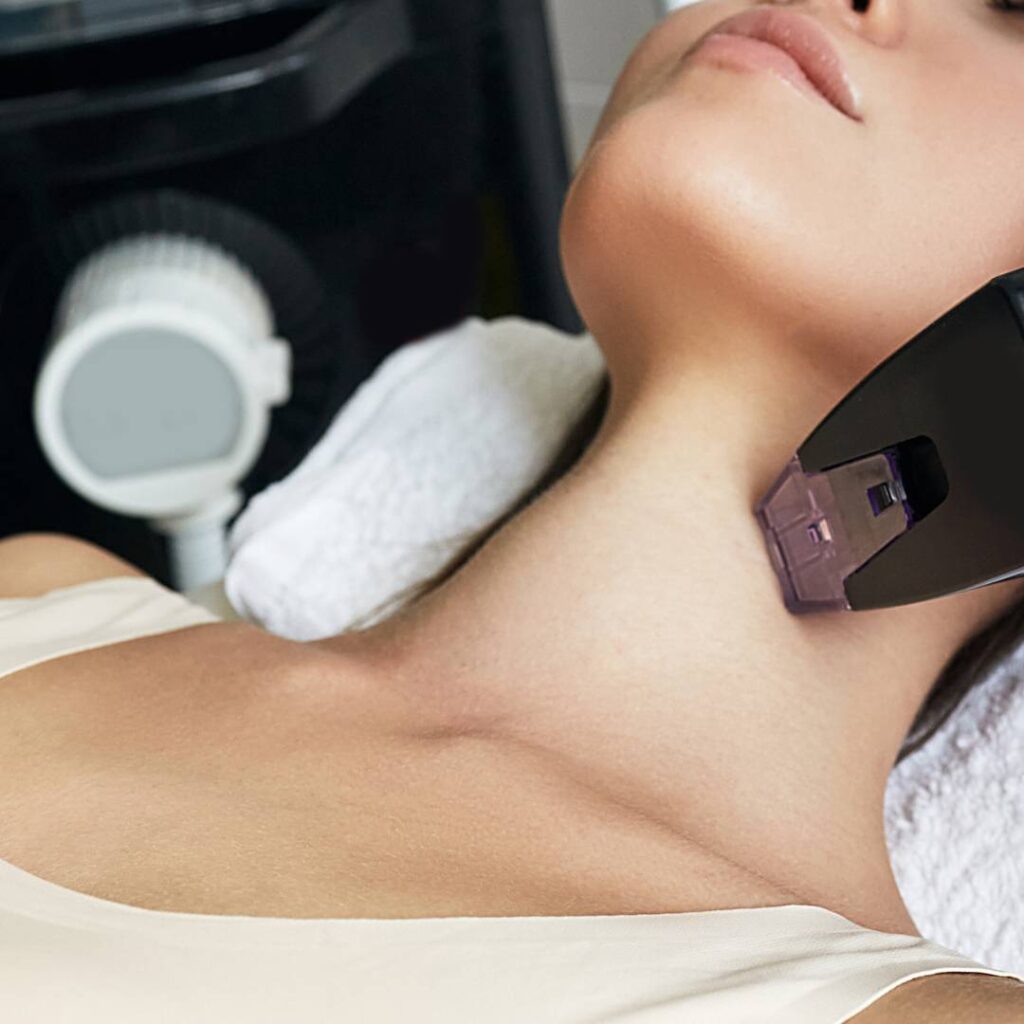 Woman receiving Microneedling to tighten loose neck skin